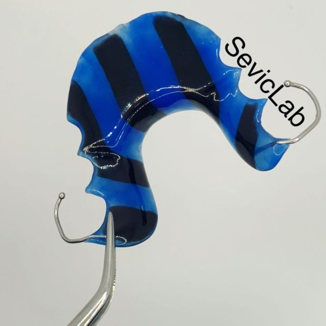 Anterior bite plate with some black and blue stripes. #bite #plate #black #blue #blackandblue #stripes #orthodontics #ortho #orthodontist #dentistry #dental #dentist #dentalart #ortodoncie #ortodoncia #ortodonzia #ortodontia