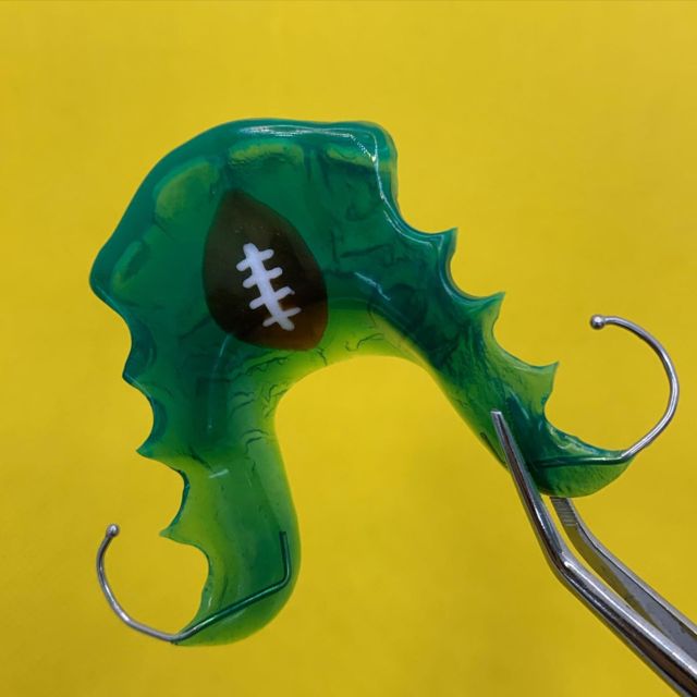 A little football on green for a little fan. #green #acrylic #football #biteplate #orthodontics #ortho #orthodontist #dentistry #dental #dentist #dentalart #ortodoncie #ortodoncia #ortodonzia #ortodontia