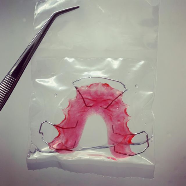 We’ve captured #lava in a bag
#lavared #acrylic #hawley #retainer #adamsclaps #phase1 #orthodontics #ortho #orthodontist #dentistry #dental #dentist #dentalart #ortodoncie #ortodoncia #ortodonzia #ortodontia