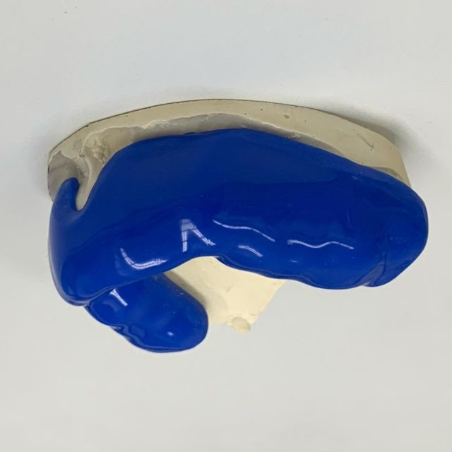 Play it safe and wear your mouth guard. #mouthguard #soft #sports #guard #blue #3mm #orthodontics #ortho #orthodontist #dentistry #dental #dentist #dentalart #ortodoncie #ortodoncia #ortodonzia #ortodontia